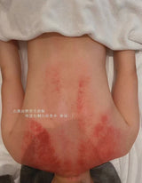 经络推拿  Han&Tang dynasty therapy TUINA