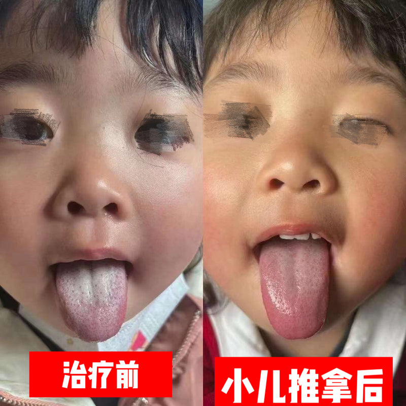 小儿推拿