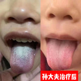 小儿推拿