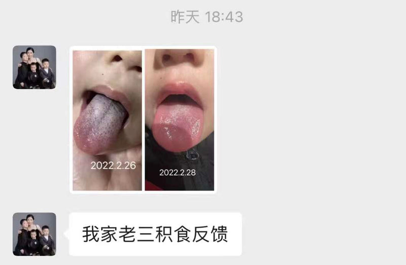 小儿推拿