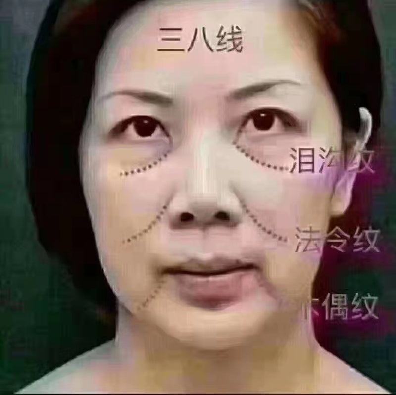 脸部及颈部除皱或瘦脸 face lift