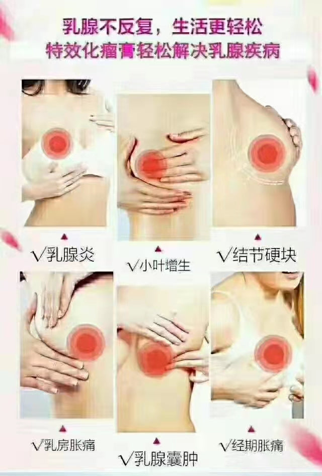 乳腺疏通