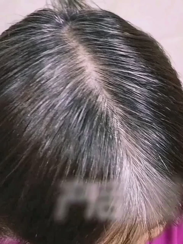 生发液——增发密发快速防脱发头发增长液生发液长发剂秃顶育发液男女士 100ml-脱发白发孕妇可用